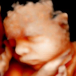 Ecografía 5D Feto en posición fetal, con detalles suaves y formas difusas.