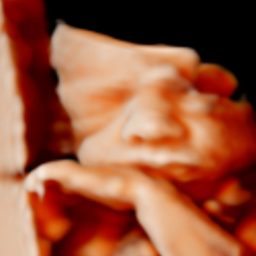 Ecografía 5D Feto en posición fetal, con detalles faciales visibles y mano cerca de la cara.